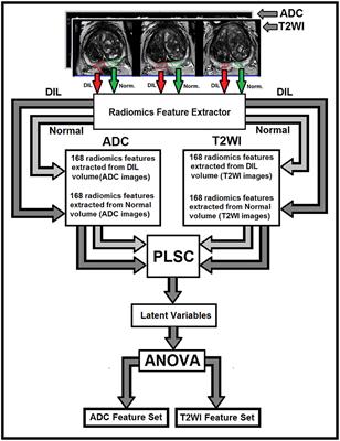 Detection of Dominant Intra-prostatic Lesions in Patients With Prostate Cancer Using an Artificial Neural Network and MR Multi-modal Radiomics Analysis